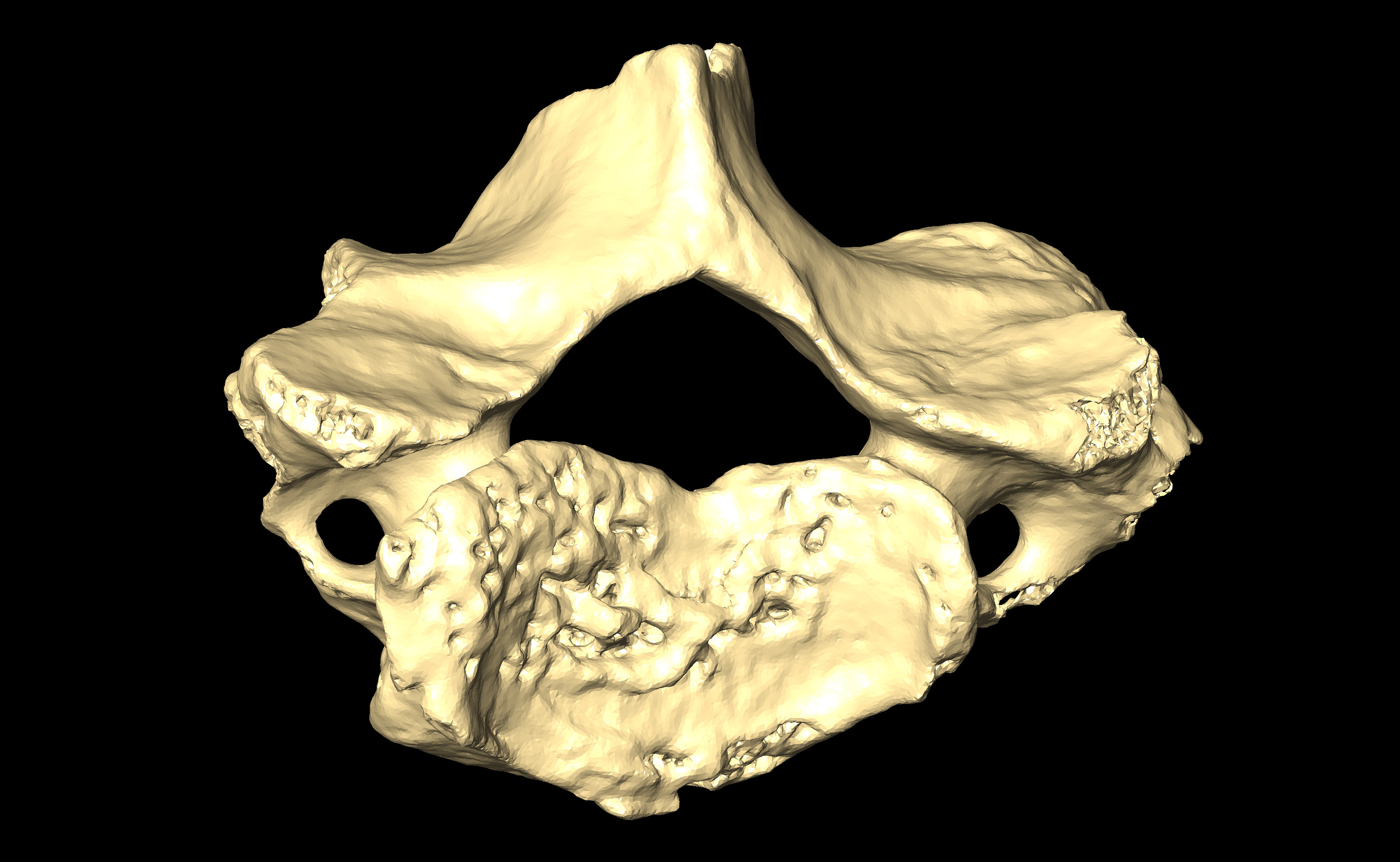 MNHN-HA-4272 Cervical Vertebra 7