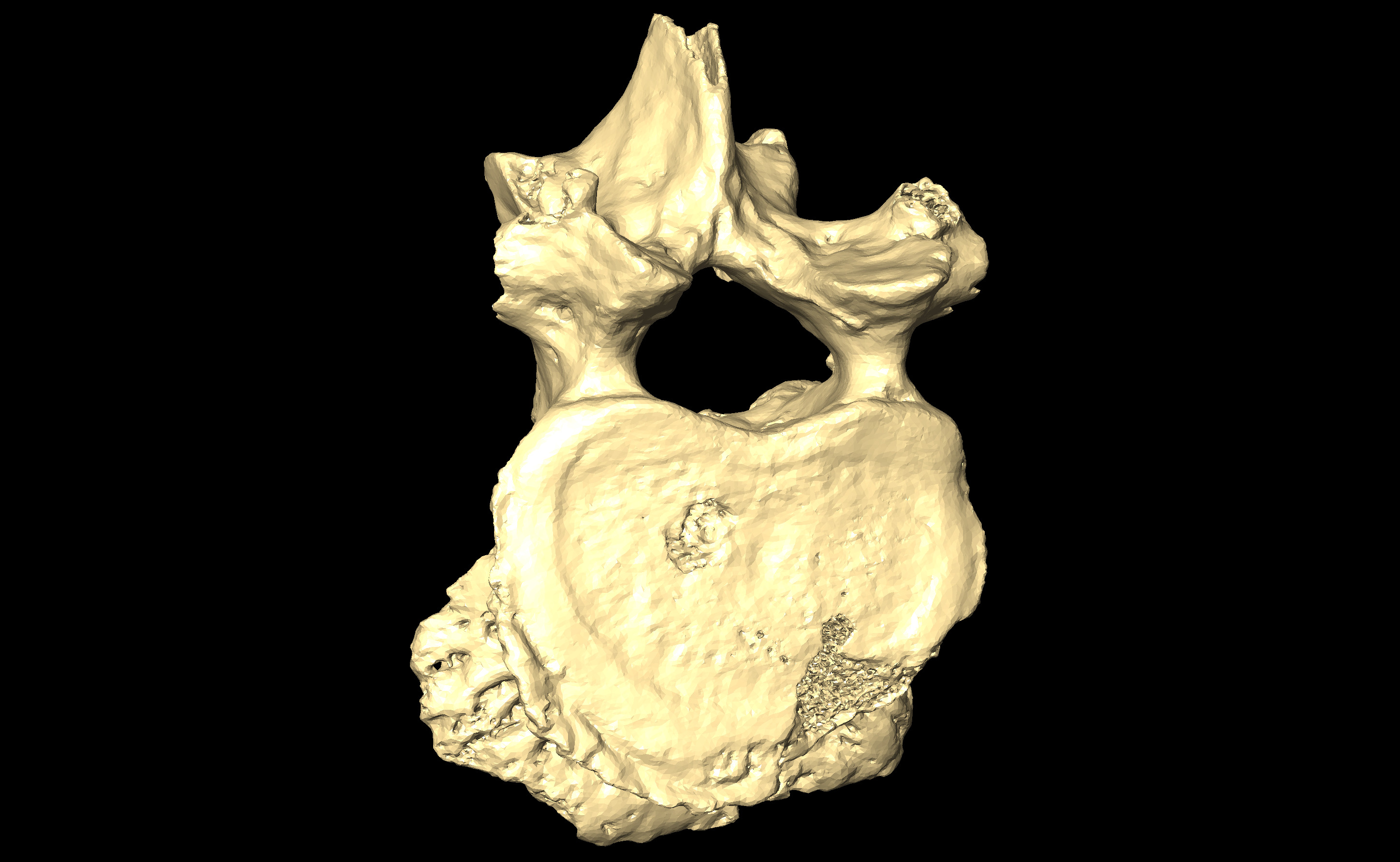 MNHN-HA-4285 Lumbar Vertebra 1